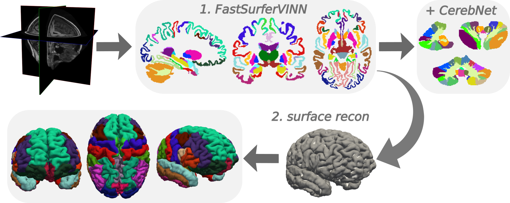 FastSurfer whole-brain segmentation and surface reconstruction